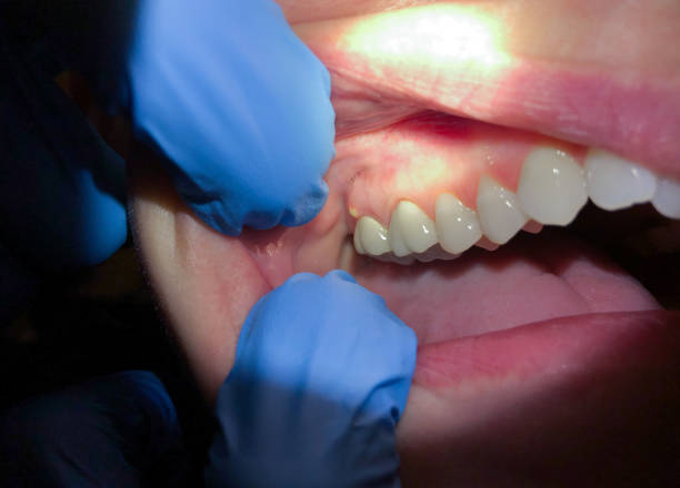 Best Emergency Dental Care for Trauma or Injury in Warrenton, GA
